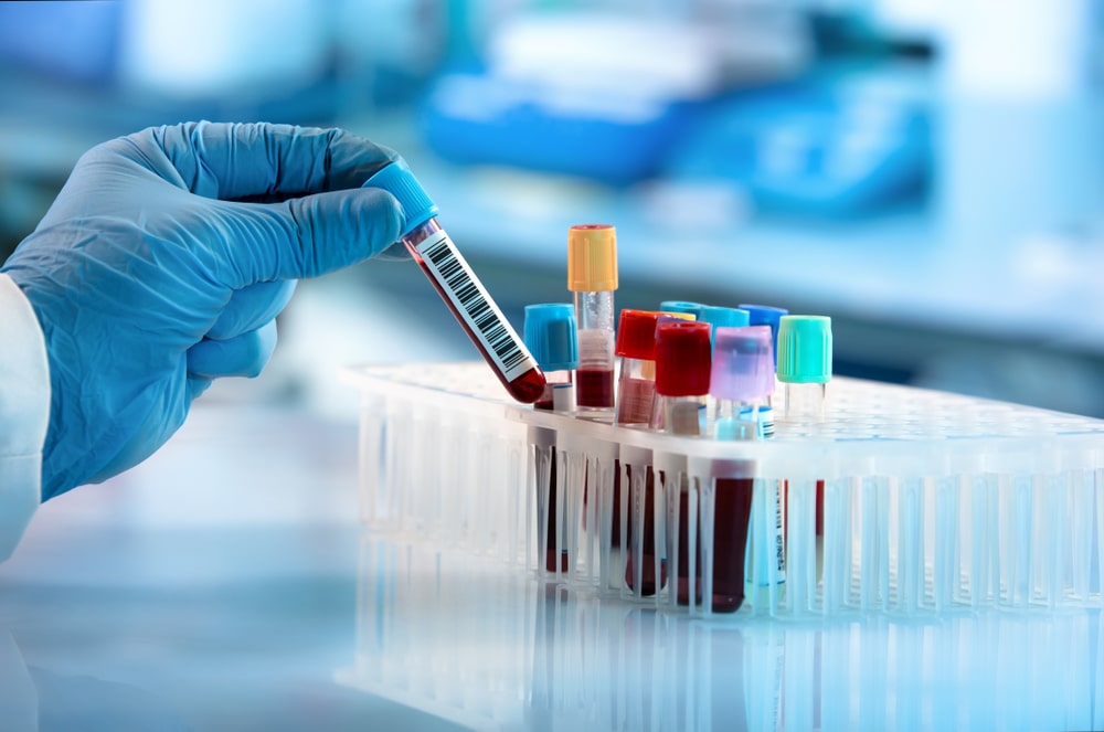 badr-lab-dispositifs-medicaux-algerie (3)
